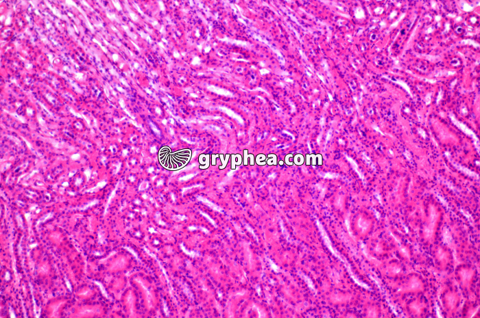 Tubules Rein x40 - gryphea.com